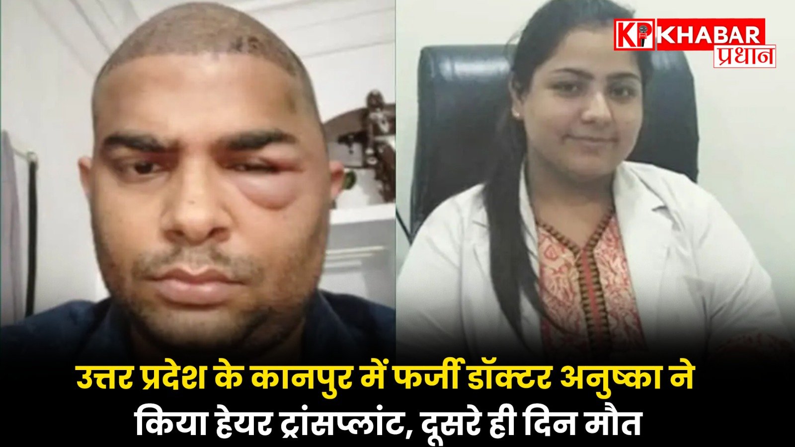 उत्तर प्रदेश के कानपुर में फर्जी डॉक्टर अनुष्का ने किया हेयर ट्रांसप्लांट ! दूसरे ही दिन मौत!