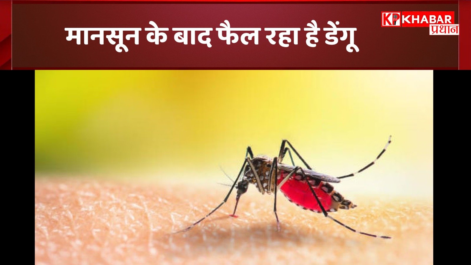 डेंगू : मानसून के बाद फैल रहा है डेंगू, क्या है लक्षण और कैसे करें बचाव