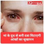माँ के दूध से बनी दवा दिलाएगी “Dry Eye” से छुटकारा! दिल्ली AIIMS में सफल ट्रायल.