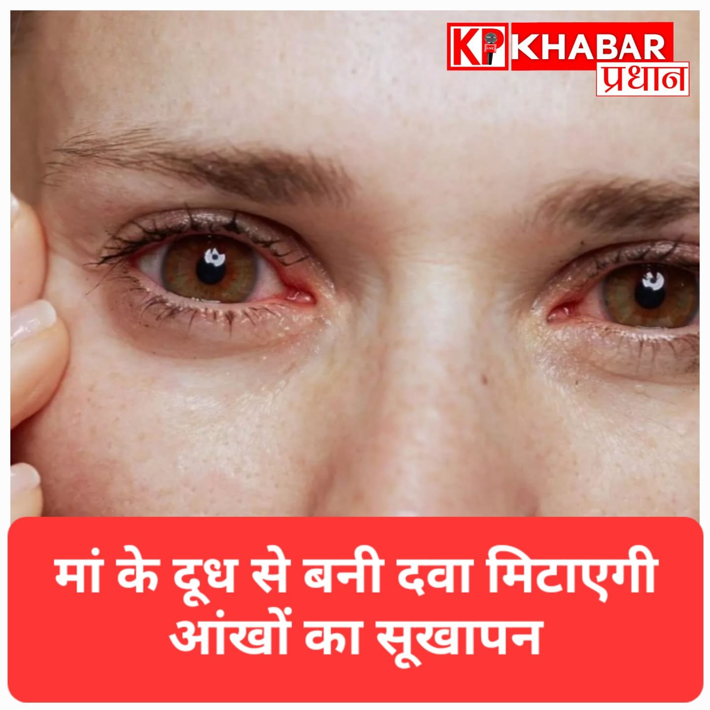 माँ के दूध से बनी दवा दिलाएगी “Dry Eye” से छुटकारा! दिल्ली AIIMS में सफल ट्रायल.