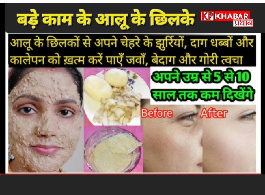 आलू के छिलकों का करें इस्तेमाल सौंदर्य में: त्वचा और बालों में निखार लाये आलू के छिलके: